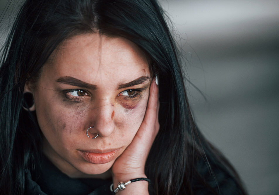 Portrait of beaten young woman with bruise under eye indoors in abandoned building.