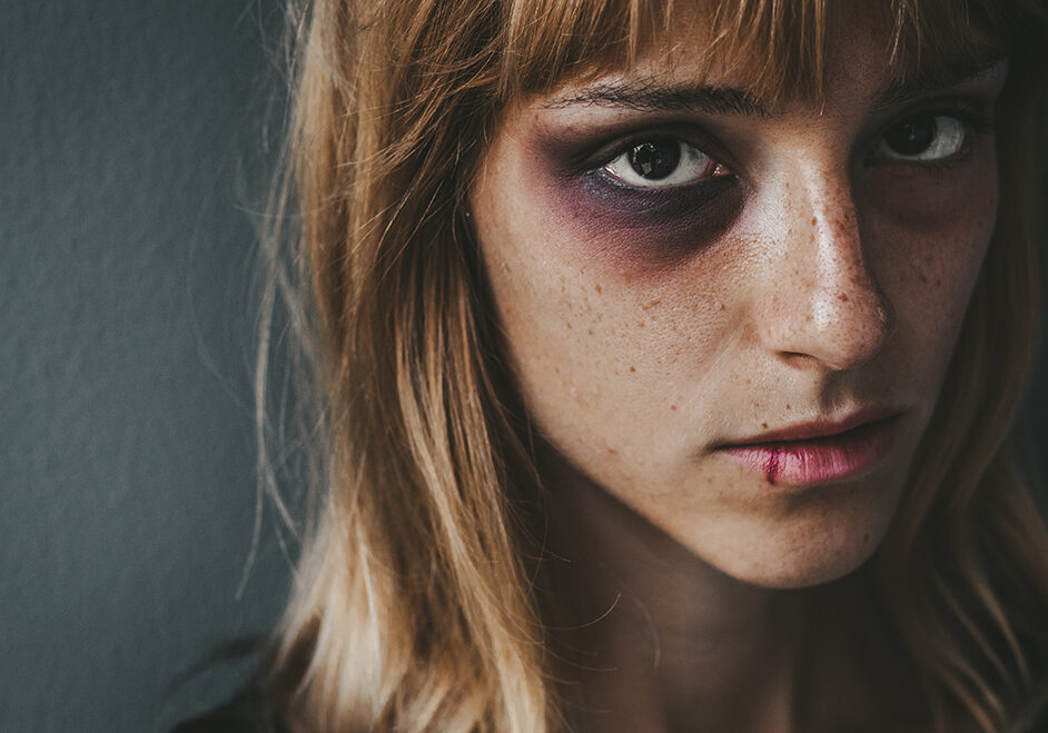 stop-violence-against-women-concept-CKXLDL5